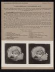 Cranio-Cerebral Topography - no. 7